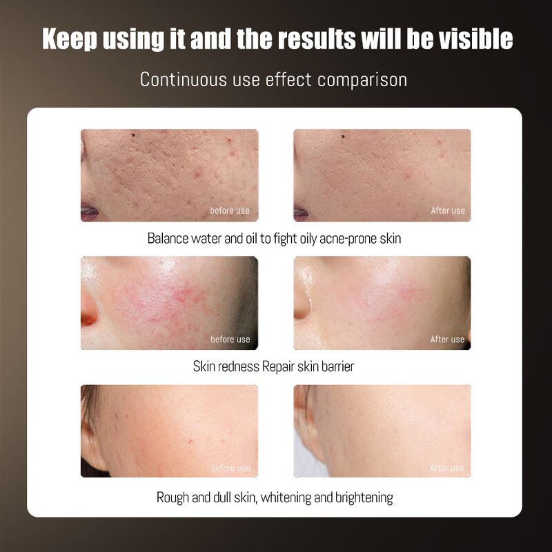 8 Color Silicone LED Mask - Advanced Photon Red Infrared Therapy Device