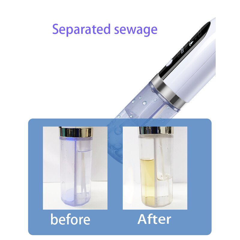 Pore Vacuum Blackhead Remover - Electric Small Bubble Acne Pimple Cleaner