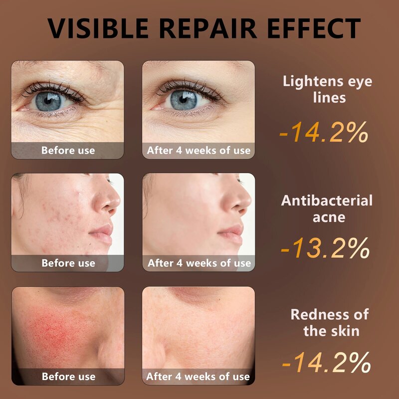 LED Mask Manufacturer - Portable Infrared Red Light Therapy Contour Face with Portable Light for Home Travel