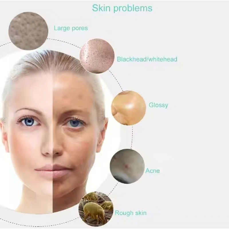 Face Brush Manufacturer - 360° Rotating Electric Rechargeable Multifunctional Silicone for Cleansing Exfoliating LED UK/EU