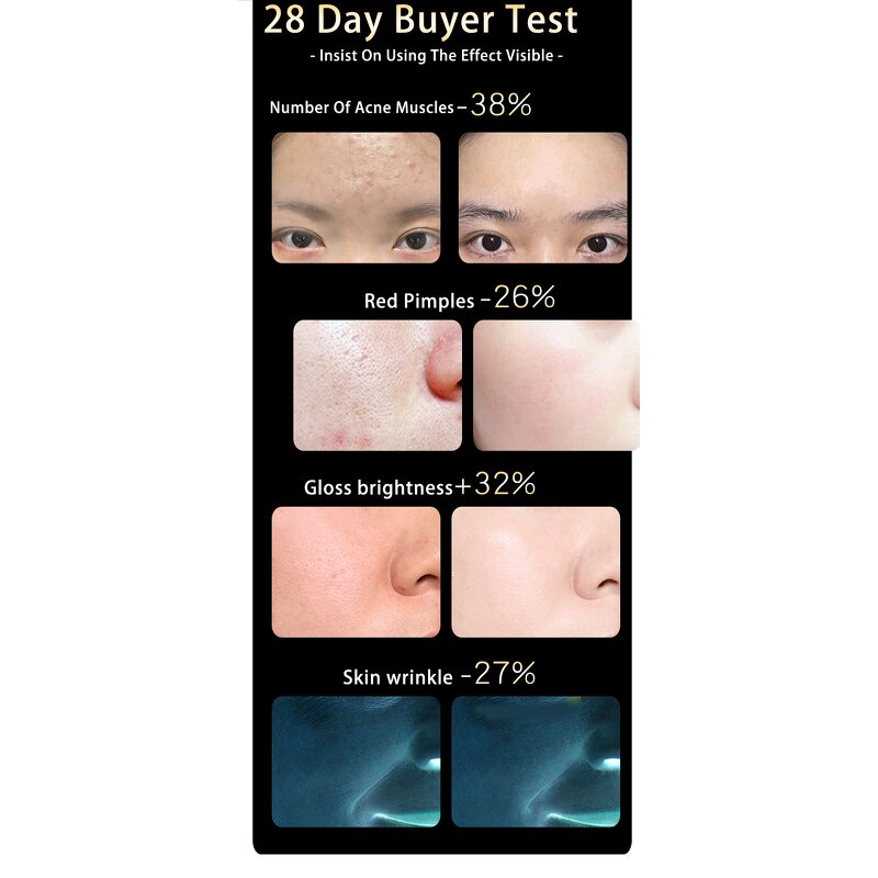 LED Light Therapy Mask Manufacturer - Professional Pink 4 Colors Silicon Face Light Therapy