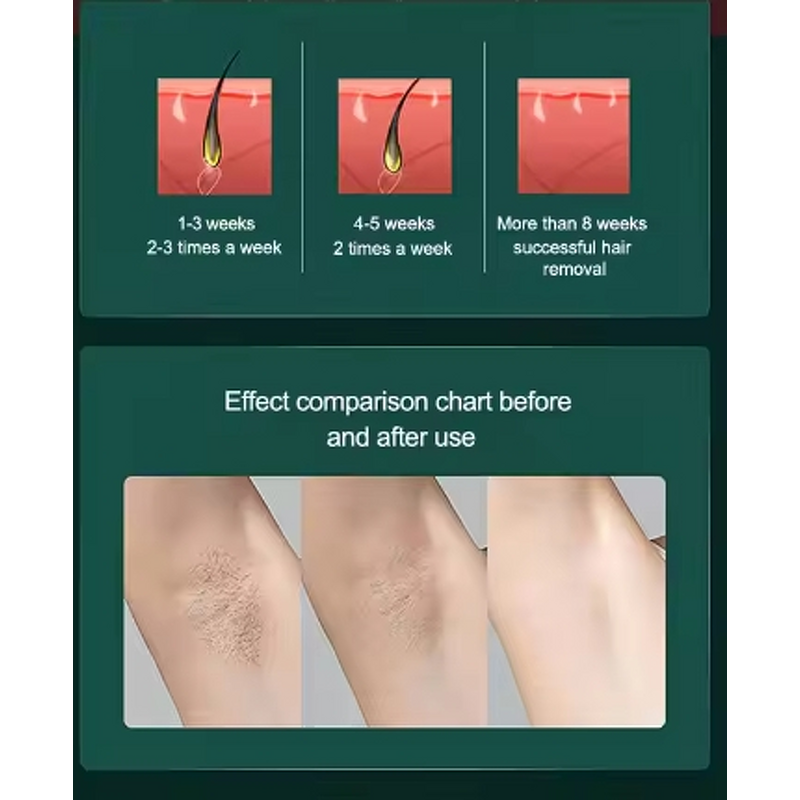 IPL Hair Removal Machine Manufacturer - 2023 Professional Black Color Painless Laser Epilator for Permanent Hair Reduction