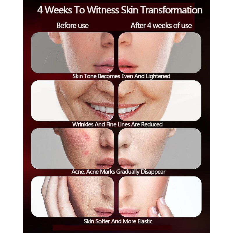 LED Facial Mask Manufacturer - Wholesale Photon Beauty 7 Colors Light Therapy Electric Led