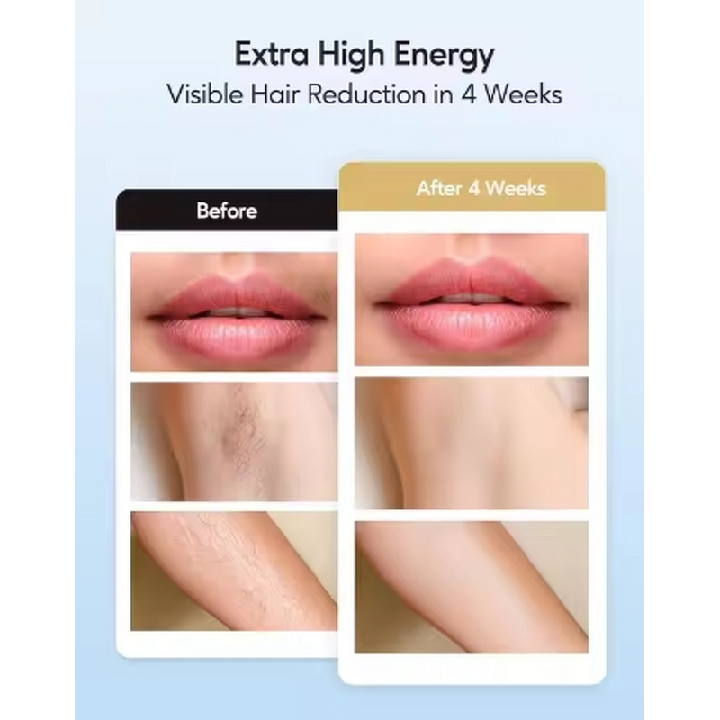 IPL Machine Manufacturer - Toplifee TH7 Upgraded 999,999 Flashes with Ice-Cool Technology for Face Legs Arms Bikini