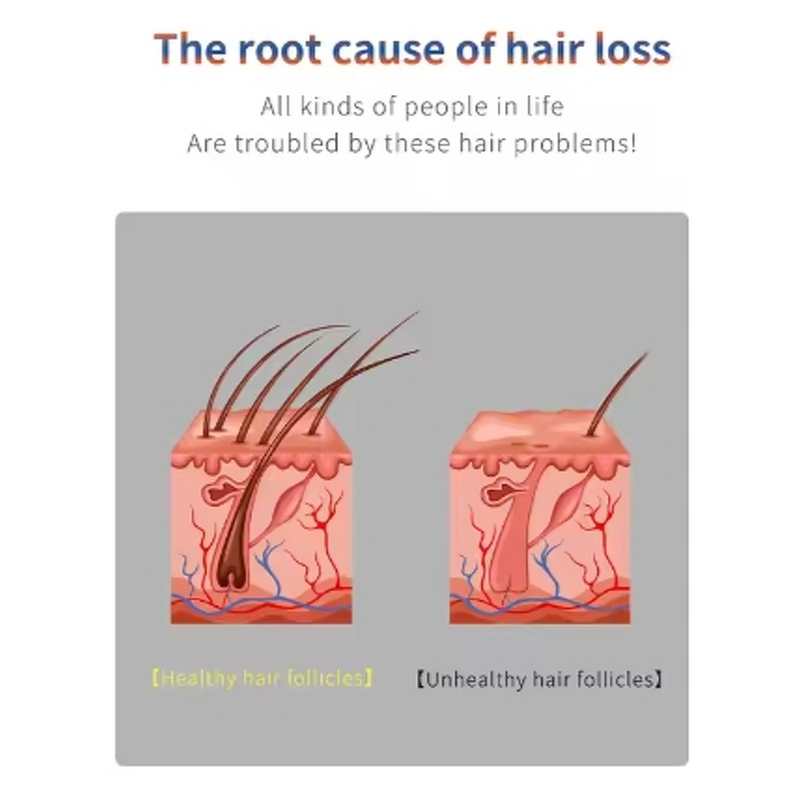 Hair Comb Manufacturer - 2023 New Beauty Laser Vibration Electric Anti-Hair Loss with Phototherapy LED & Oil Applicator