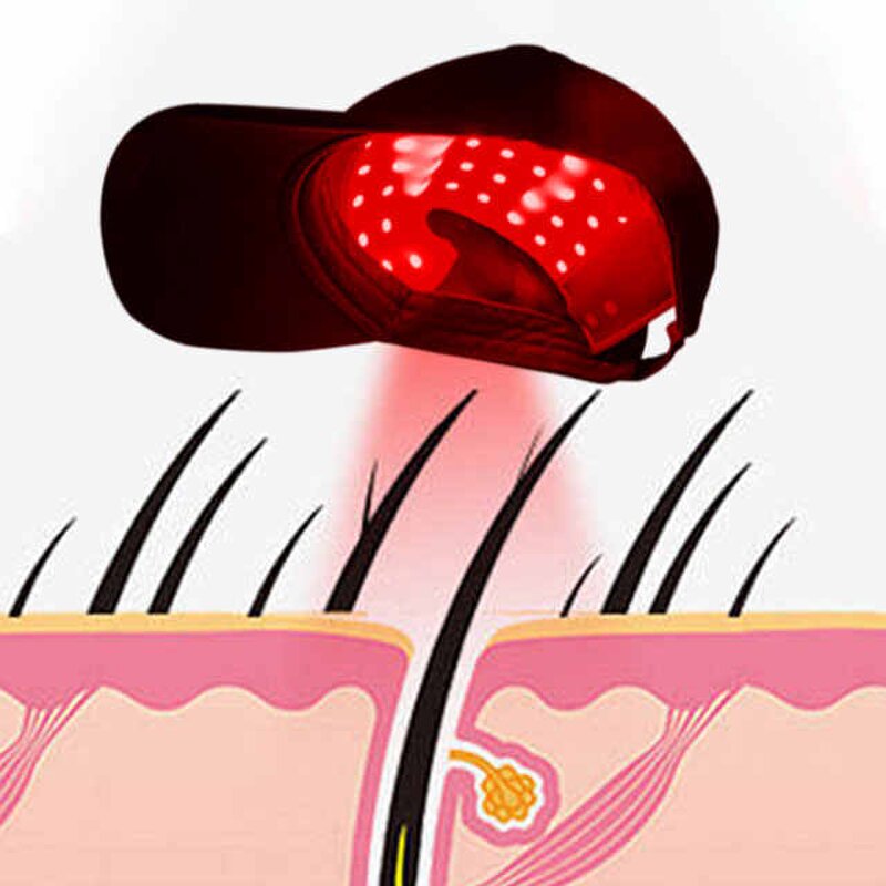 Red Light Therapy Device Manufacturer - Professional Laser Infrared Hat for Hair Regrowth & Growth