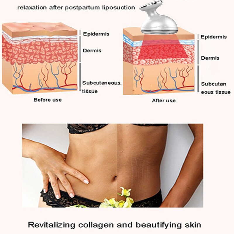 Body Sculpting Device Manufacturer - Personal Care for Cellulite Removal Slim Cavitation RF Home Fat Burning