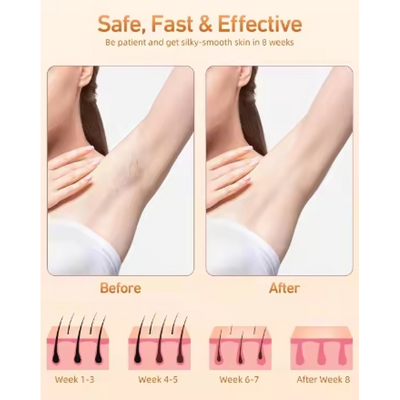 Laser Epilator Manufacturer - Handheld Painless IPL with Ice-Cooling for Face & Body Hair Removal Home Use