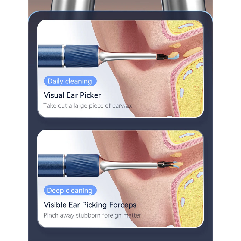 Ear Wax Removal Tool Manufacturer - with 12MP Camera Omnidirectional Tweezers Wireless & 6 Ear Spoon