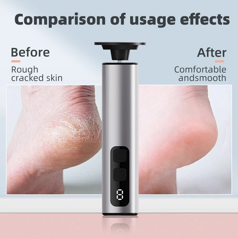 Electric Nail Grinder Manufacturer - 1800mAh Rechargeable for Callus Removal & Pedicure Dead Skin