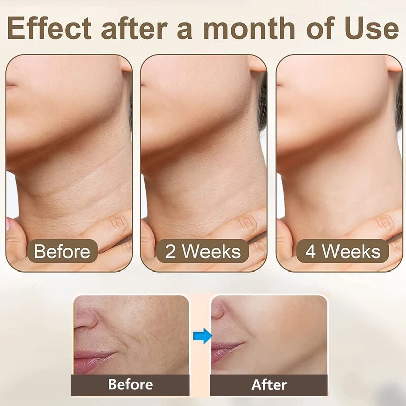 Facial Slimming Machine - Nove Home Face Lift Skin Tightening Massager