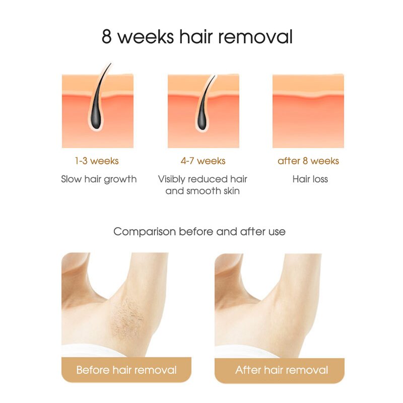 Household IPL Hair Remover - Painless Facial Armpit Men Women Tool