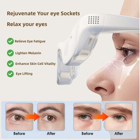 Electric Eye Massager - Hot Cold Seven Device Eye Bag Dark Circles Reliever