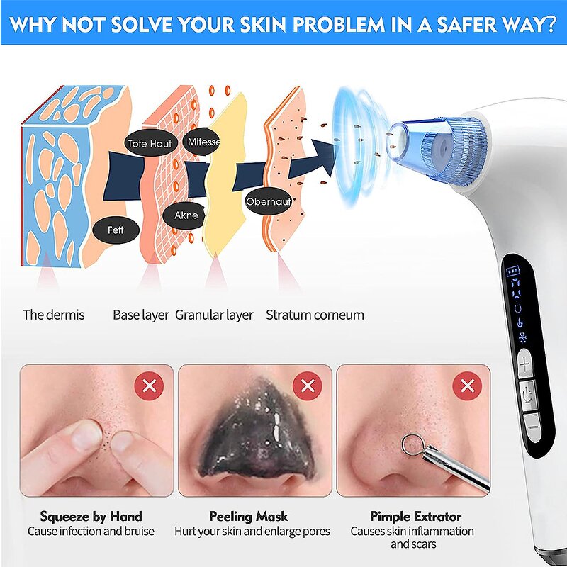 Electric Blackhead Remover - OEM Heated Suction Hot Cold Pore Cleaner