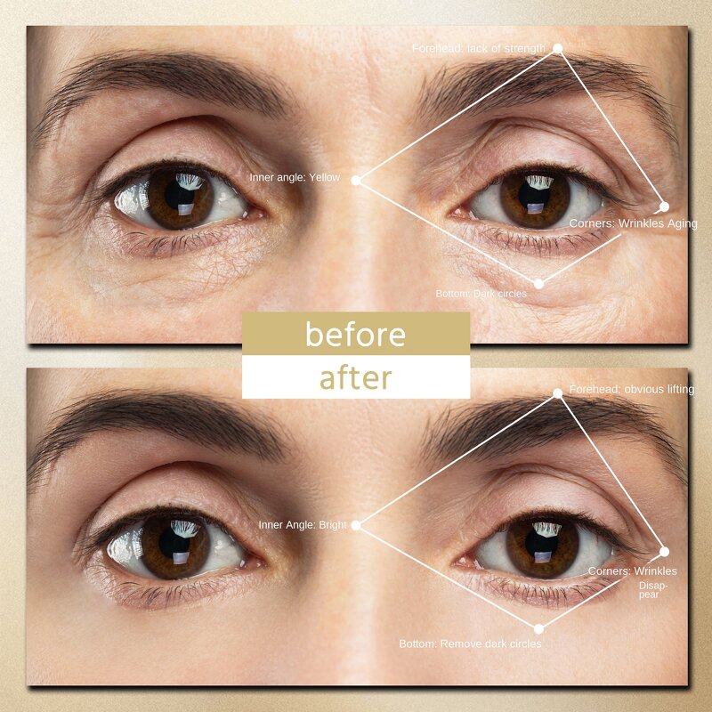 Electric Eye Beauty Instrument - US Plug Anti-Aging Dark Circles Tool