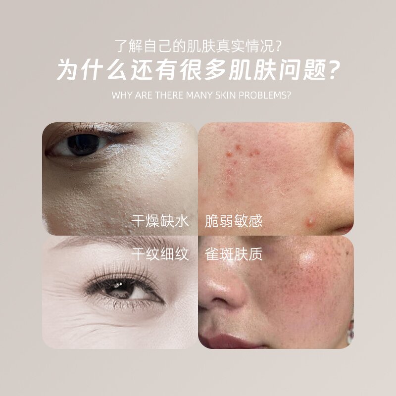 USB Skin Analyzer Pen - Rechargeable LED Moisture Oil Analysis Tool