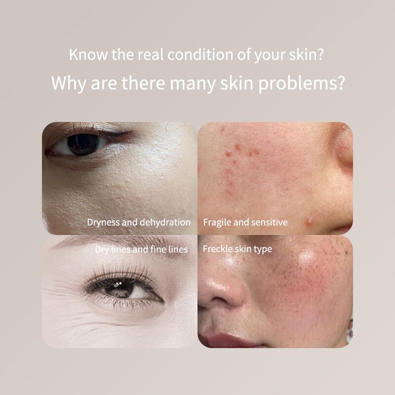 Digital Skin Moisture Analyzer - TikTok Hot Sale Facial Water Oil Tester