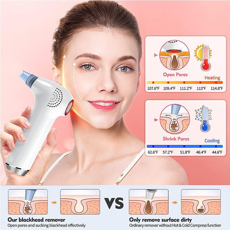 Electric Blackhead Remover - OEM Heated Suction Hot Cold Pore Cleaner