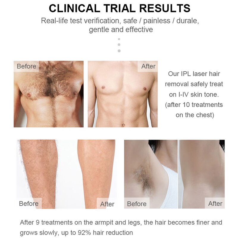 Home IPL Hair Machine - Face Body Ice Cooling LED Indicator US CN Plug