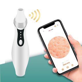 Electric Facial Cleaner - Customizable Comedone Extractor Vacuum Tool