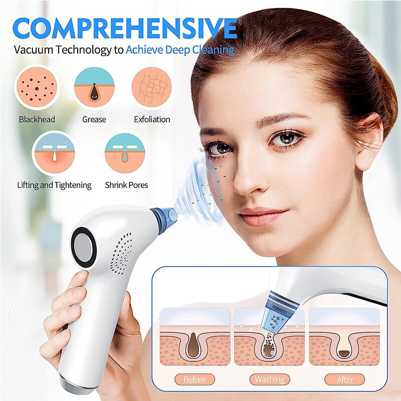 Electric Blackhead Remover - OEM Heated Suction Hot Cold Pore Cleaner