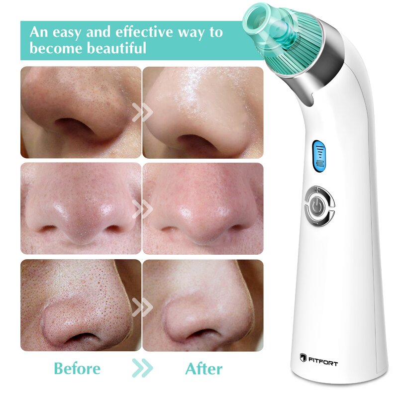 Professional Blackhead Remover - Strong Suction Pore Vacuum Acne Tool
