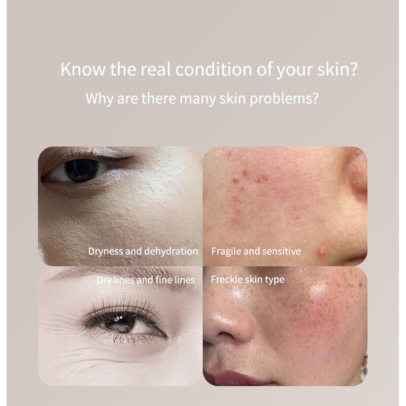 Digital Skin Analyzer - Mini Home Moisture Oil Humidity Detection Machine