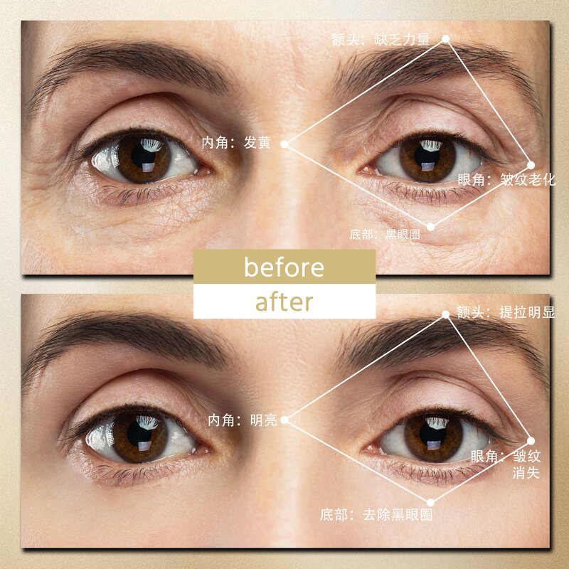 Electric Eye Beauty Instrument - Massage Relieves Dark Circles Eye Bags