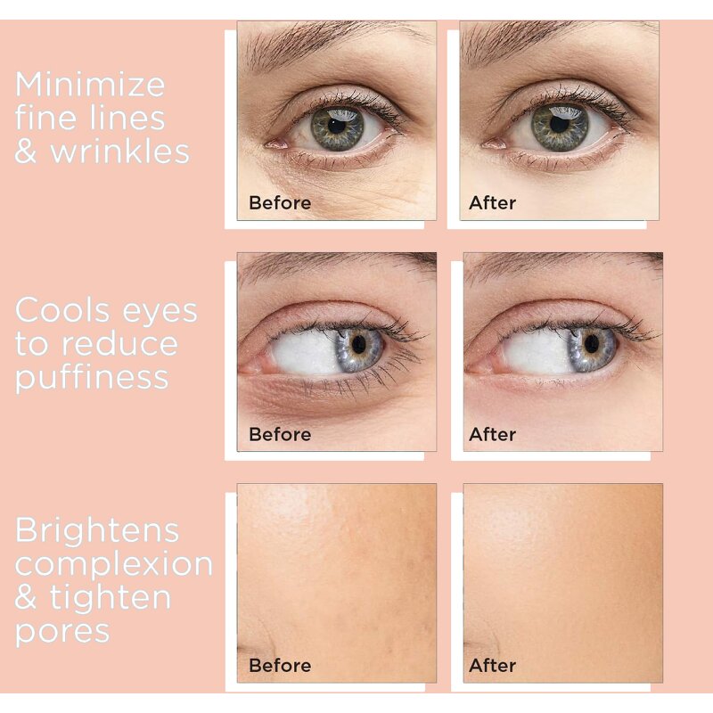 Cryo Sticks Manufacturer - White Stainless Steel Ice Roller Heart Gua Sha for Face Lifting