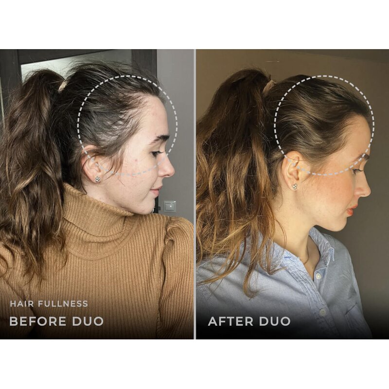 Anti Hair Loss Comb Manufacturer - Home Vibration with LED Lights Therapy Red Blue Light EMS Micro Current Electric Hair