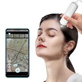 Skin Scalp Analyzer Manufacturer - Kimairay HD White Hair USB & WIFI Connected Hair Follicles Scanner Home Use Detector