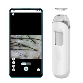 Scalp Testing Tool Manufacturer - Kimairay USB WIFI Android Phone Tablet Compatible Hair Follicle Analyzer and Detector