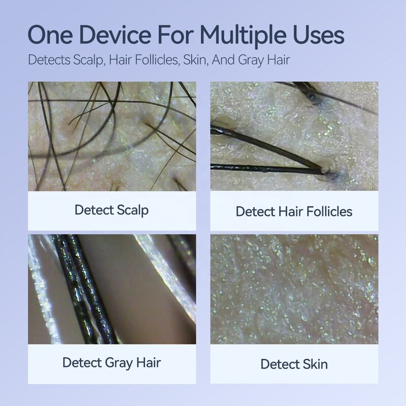 Skin Scalp Analyzer Manufacturer - Kimairay HD White Hair USB & WIFI Connected Hair Follicles Scanner Home Use Detector