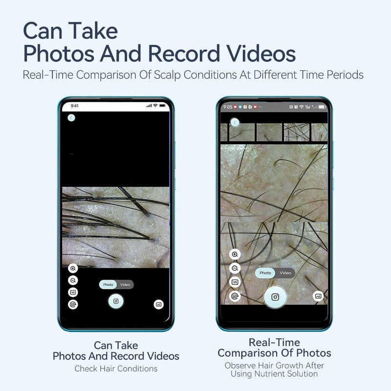 Digital Microscope Manufacturer - Kimairay 50-200X USB WIFI Connection for Hair Follicle Scalp Skin Management Analyzer