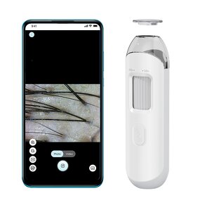 Skin Hair Analyzer Manufacturer - Kimairay USB WIFI Android Phone Connected HD Detection for White Hair Scalp Care Home Use