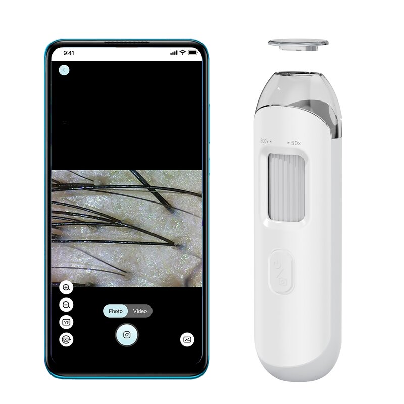 Skin Hair Analyzer Manufacturer - Kimairay USB WIFI Android Phone Connected HD Detection for White Hair Scalp Care Home Use
