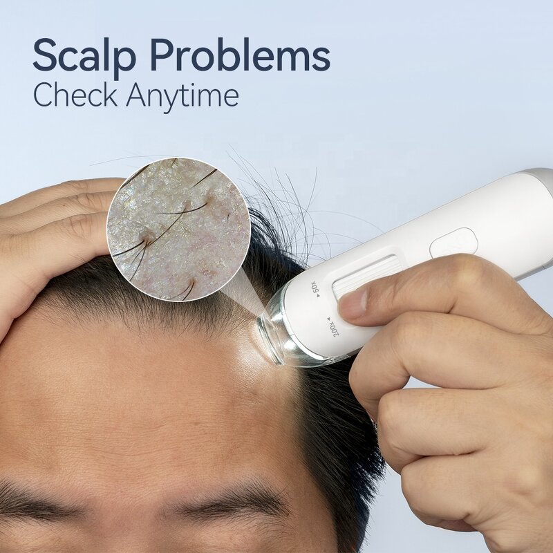 Scalp Testing Tool Manufacturer - Kimairay USB WIFI Android Phone Tablet Compatible Hair Follicle Analyzer and Detector