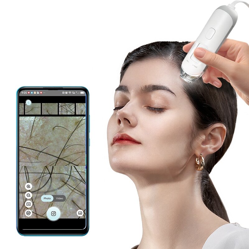 Hair Follicle Analyzer Manufacturer - High-Precision USB WIFI Adjustable Focus Inspection Mirror for Home Skin Care