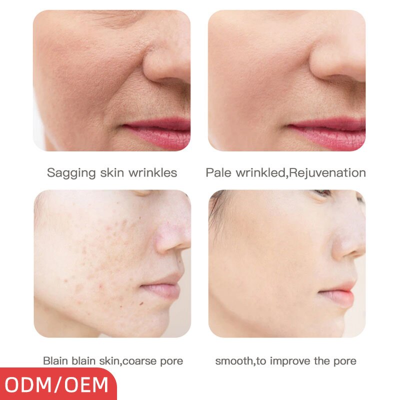 Beauty Mask Manufacturer - Newly Designed Portable Gold with Red Blue Orange Led Antiaging