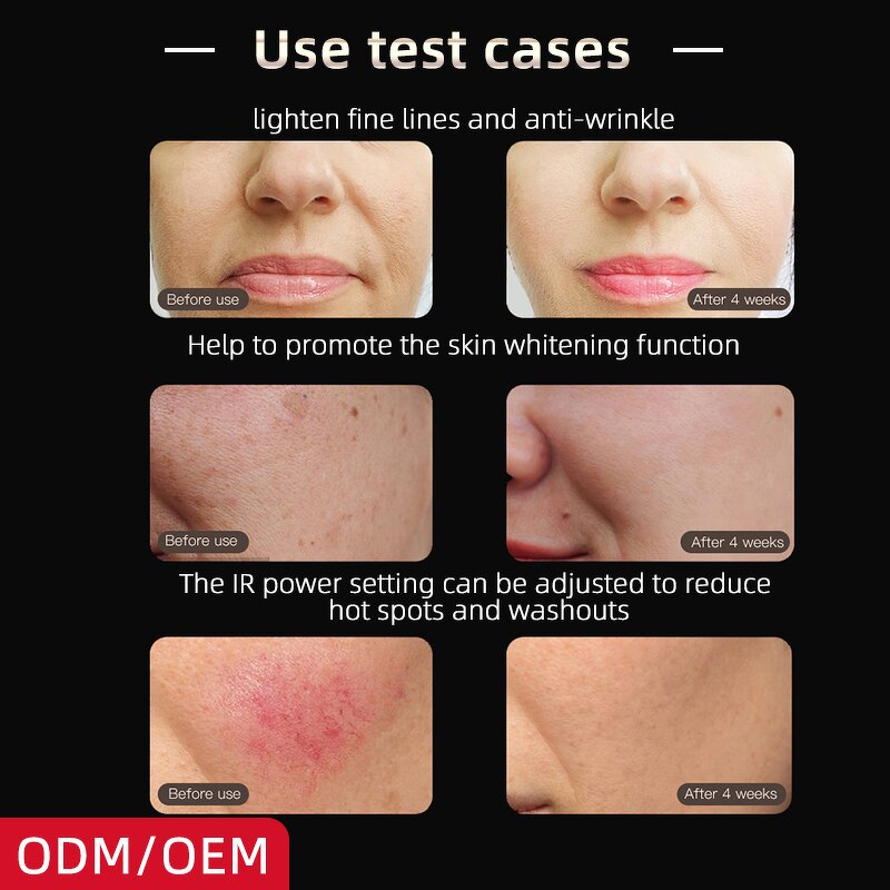 LED Face Mask Manufacturer - New 4 Colors Red Light Therapy for Silica Gel Neck Photon NIR Skin Rejuvenation