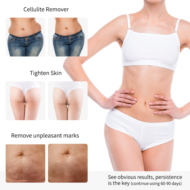 Beauty Device Manufacturer - Beperfect Ems LED Light Therapy Hand-held RF for Skin Tightening & Firming Home Use with US Plug