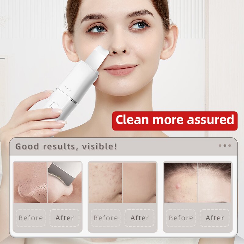 Skin Care Device Set Manufacturer - Beperfect High Quality Multifunctional for Home Use Beauty Equipment