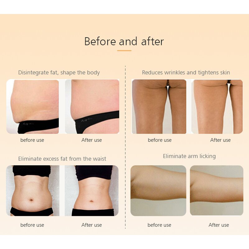 Weight Loss Beauty Device Manufacturer - Beperfect for Home Use Beauty Equipment