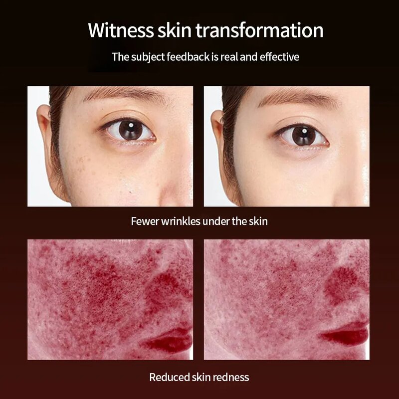 LED Facial Mask Manufacturer - 2023 New Beauty Soft Silicone Infrared Red Therapy