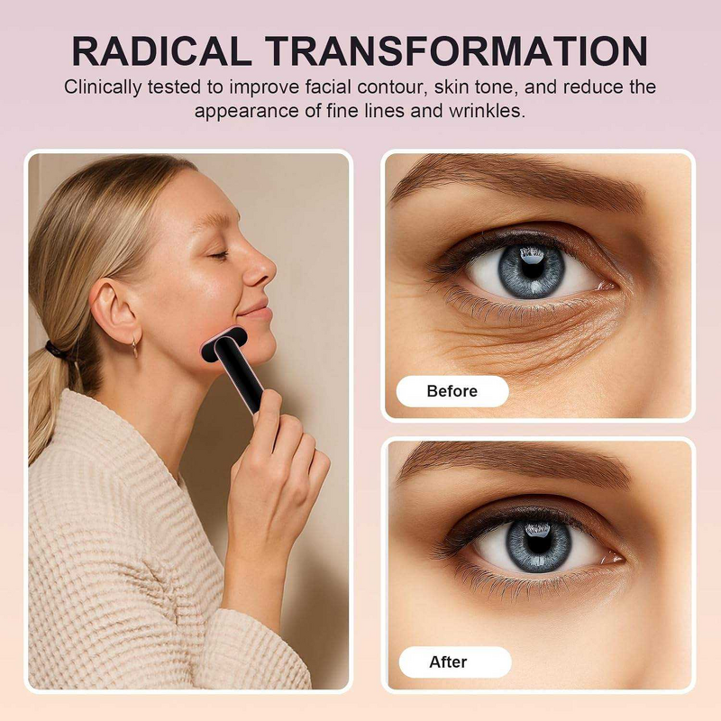 Eye Face Massager Manufacturer - OEM ODM Private Label Vibration EMS LED Electric Heat for Anti-wrinkle Reduce Puffiness