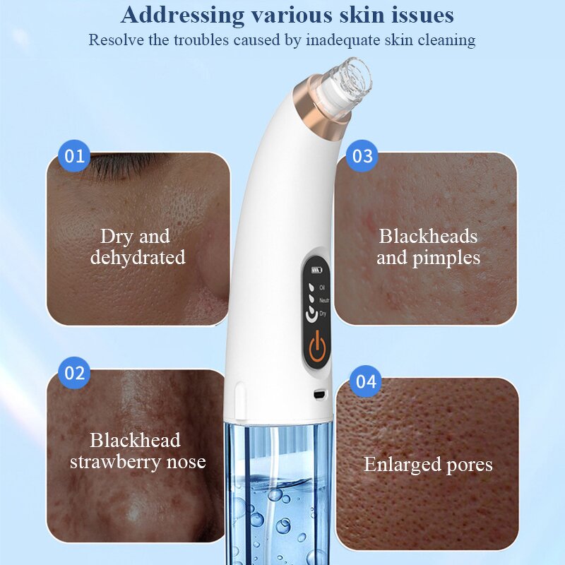 Blackhead Remover - Vacuum Suction Acne Removal Facial Cleaning Tool