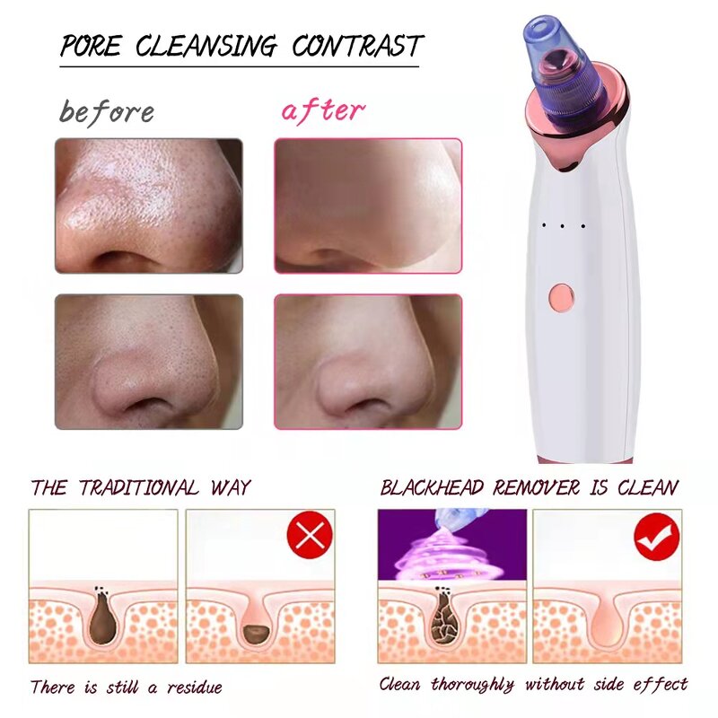 Blackhead Vacuum - Custom Private Label Pore Cleaner Exfoliating Tool