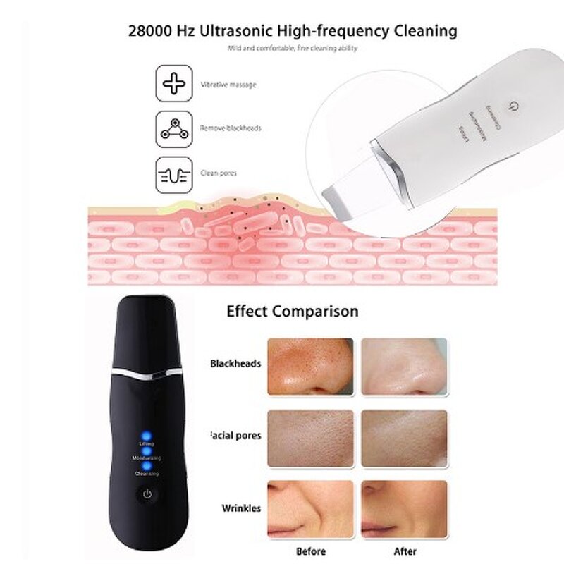Ultrasonic Skin Scrubber - Deep Cleansing Exfoliating Peeling Beauty Instrument