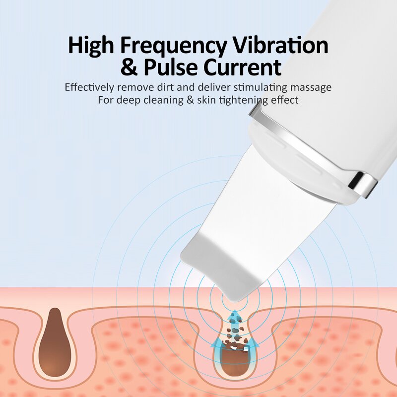 Ultrasonic Spatula - Electric Facial Acne Blackhead Cleansing Tool