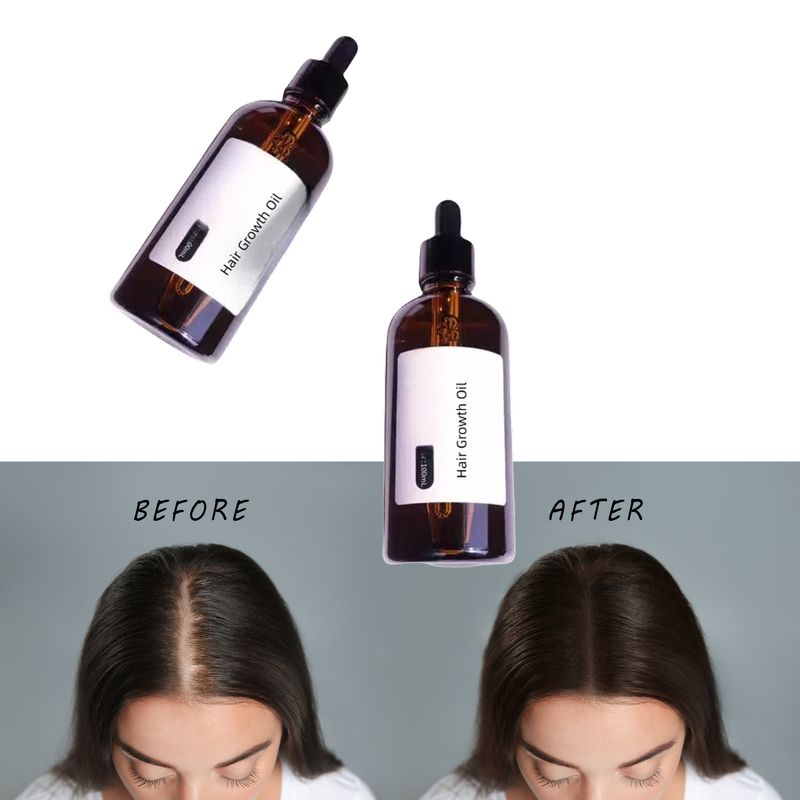 Hair Growth Oil - Regrowth Lavar Rosemary Onion Coconut Anti Loss Fast